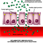 10 Ways To fight leaky gut in Mold Illness